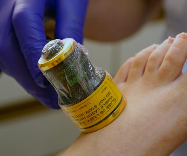 low level laser therapy device placed onto foot